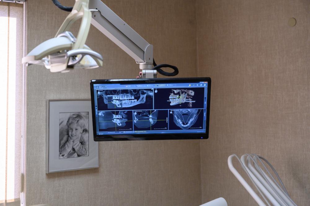 digital dental x-rays on a screen in a dental treatment room