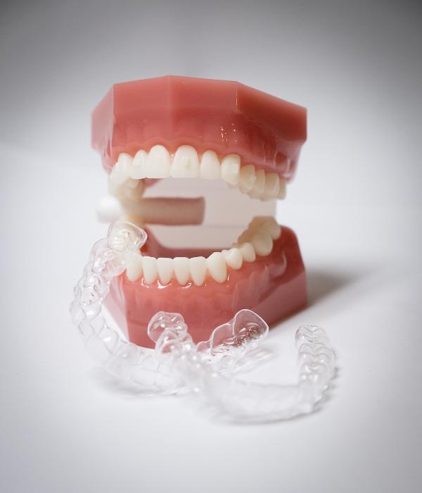 tooth mold with plastic aligners in front of it