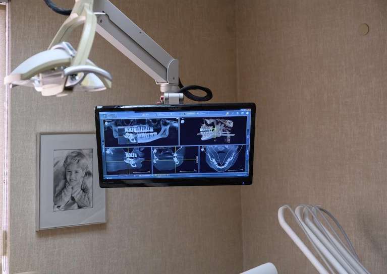 digital x-rays on screen in troy dental office
